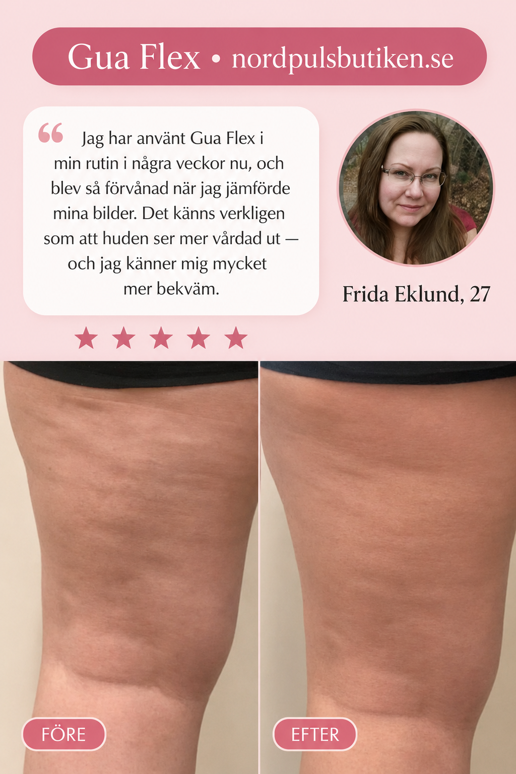 Gua Flex - minskar celluliter på lår, mage och rumpa på 3 minuter